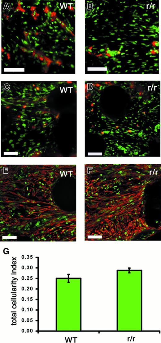 Fig. 10. Collagenase-resistant implants exhibit a deficiency of endothelial cells but not other cell types. / WT or collagenase-resistant, r/r collagen at equal concentrations was copolymerized with buffer alone or bFGF/VEGF, prior to placement on the chick CAM. The embryos containing the collagen implants were incubated for 66 hours. Immunofluorescent detection of multiple cell types revealed a deficiency only of endothelial cells in collagenase-resistant (B,D,F) compared to WT (A,C,E) implants. Staining is shown for the endothelial cells with anti–von Willebrand factor (A,B), PMN heterophils with antichicken MMP-9 (C,D), or myofibroblasts with antismooth muscle actin (E,F). Bar indicates 50 μm. (G) Total cellularity was similar between collagenase-resistant and WT implants, as indicated by image analysis of total nuclear staining in the upper region of the implants. Data shown in bar graphs are the average of 5 independent samples ± SEM Mann-Whitney U test: n = 5, P > .05.