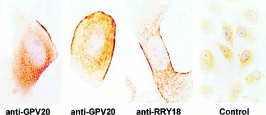 Fig. 1. Visualization of CK1 on nonpermeabilized EA.hy926 endothelial cells. / EA.hy926 cells were grown on permanox tissue culture chambers, fixed with PLPG, and then treated with anti-GPV20, anti-RRY18, or goat IgG (control). After incubation, the slides were treated with a rabbit antigoat antibody and immunostained by the peroxidase/antiperoxidase method as described in “Materials and methods.” The figure is a representative experiment of 2.