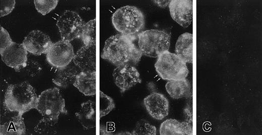 Fig. 2. Recognition of CK1 on sections of EA.hy926 endothelial cells. / Five- micrometer sections of a cell suspension fixed with PLPG were incubated with anti-GPV20 (A), anti-RRY18 (B), or goat IgG (C) as described in “Materials and methods.” The bound antibodies were visualized by an FITC-labeled rabbit antigoat antibody. The figure is a representative experiment of 2. Note the arrows in panels A and B point to the placement of membrane antigen.