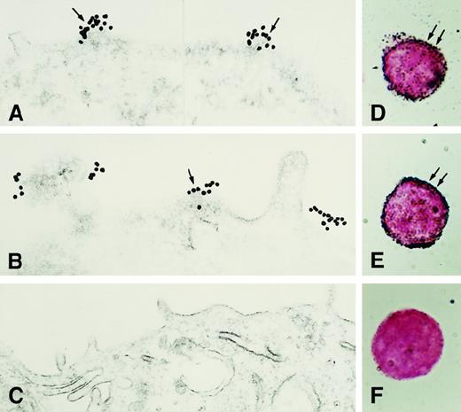 Fig. 3. Immunoelectron microscopy for CK1 antigen on nonpermeabilized EA.hy926 endothelial cells. / Cell suspensions were fixed with PLPG and incubated with anti-GPV20 (A,D), anti-RRY18 (B,E), or nonimmune goat IgG (C,F). The bound cytokeratin antipeptide antibodies were visualized by an immunogold procedure. Clusters of 10-nm gold particles, indicating the presence of bound anti-GPV20 and RRY18, are seen segmentally on the endothelial plasma membrane (arrows) (A,B). Insets show immunostained cells at the light microscopic level after silver enhancement (D,E). The figure is a representative experiment of 2.