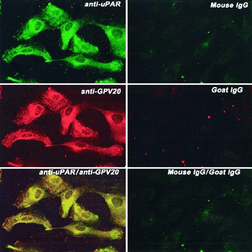 Fig. 7. Colocalization of CK1 and uPAR on HUVECs. / HUVECs grown on microscope slides were fixed with 2% paraformaldehyde and not permeabilized. The panels to this figure are photomicrographs of the laser scanning confocal micrographs. The cells in this figure were doubly labeled with primary and secondary antibodies. Upper left panel represents cells that have been labeled with mouse anti-uPAR (8 μg/mL); upper right panel, mouse IgG. Their detection was performed with a second antibody conjugated with FITC. Middle left panel represents cells that have been labeled with goat anti-GPV20 (200 μg/mL); middle right panel, goat IgG (200 μg/mL). Their detection was performed with a second antibody conjugated with Alexa Fluor. Lower left panel represents detection of the 2 labels on these cells that were treated with both goat anti-GPV20 (200 μg/mL) and mouse anti-uPAR (8 μg/mL); lower right panel is a mixture of goat IgG (200 μg/mL), and mouse IgG (8 μg/mL). Recognition of the antibody binding was performed with the secondary antibodies labeled with Alexa Fluor and FITC simultaneously. The figure is a representative presentation of 3 independent experiments.