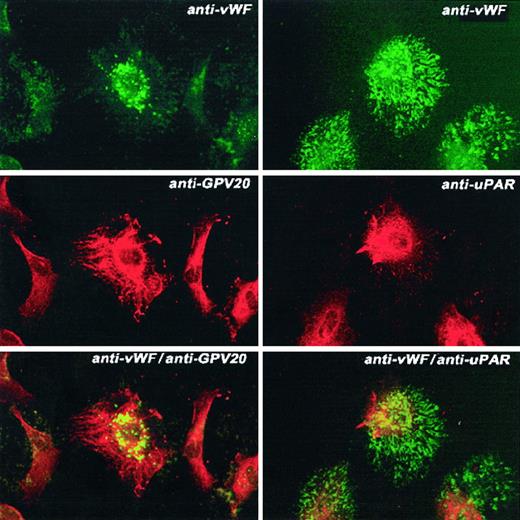 Fig. 8. Colocalization of CK1 or uPAR and vWF antigen on HUVECs. / HUVECs grown on microscope slides were fixed with 2% paraformaldehyde and not permeabilized. The panels to this figure are photomicrographs of the laser scanning confocal micrographs. The cells in this experiment were doubly labeled with the primary and secondary antibodies. The upper left and right panels are nonpermeabilized endothelial cells treated with a rabbit antihuman vWF antibody followed by a second antibody conjugated with FITC. The middle left panel shows endothelial cells incubated with the anti-CK1 antibody anti-GPV20 and the middle right panel shows endothelial cells incubated with an anti-uPAR antibody. Both antibodies were detected with a second antibody conjugated with Alexa Fluor. The lower left panel is combined anti-vWF and anti-CK1 antibodies. The lower right panel is exposure of combined anti-vWF and anti-uPAR antibodies. Recognition of the antibody binding was performed with the secondary antibodies labeled with Alexa Fluor and FITC simultaneously. The figure is a representative presentation of 2 independent experiments.