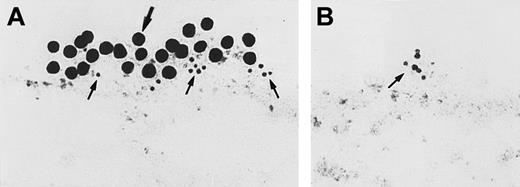 Fig. 9. Colocalization of CK1 and uPAR on transmission electron microscopy. / Double immunogold labeling for CK1 and uPAR on nonpermeabilized EA.hy926 endothelial cells. (A) Cells incubated with goat anti-GPV20 antibody and mouse anti-uPAR antibody. Bound immunoglobulins were detected with gold-labeled antigoat IgG (15 nm) and gold-labeled antimouse IgG (5 nm), respectively. (B) Cells treated with the anti-uPAR antibody followed by gold-labeled antimouse IgG (5 nm). Goat anti-GPV20 was replaced by nonimmune goat IgG, which resulted in the absence of labeling with 15 nm gold-labeled antigoat IgG. The large arrow points to CK1 antigen; the small arrows point to uPAR antigen. The figure is a representative experiment of 2.