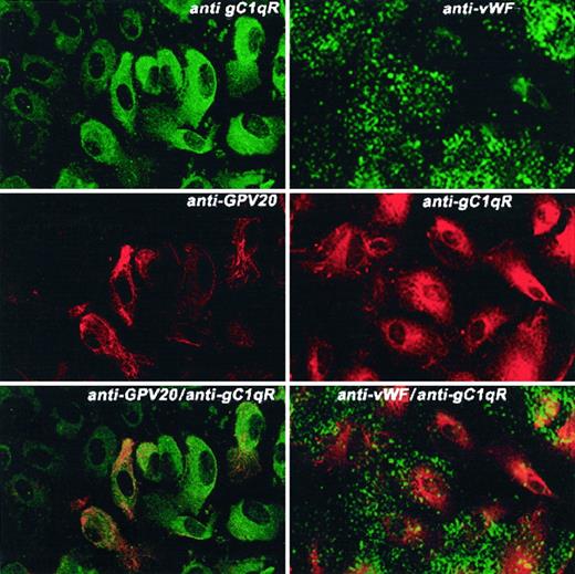 Fig. 10. Localization of CK1 and gC1qR and vWF and gC1qR on HUVECs. / HUVECs grown on microscope slides were fixed with 2% paraformaldehyde and not permeabilized. The panels to this figure are photomicrographs of the laser scanning confocal micrographs. The cells in this figure were doubly labeled with primary and secondary antibodies. The panels on the left are cells that were doubly labeled with anti-gC1qR and anti-CK1 (anti-GPV20). The panels on the right are cells that were doubly labeled with anti-vWF and anti-gC1qR. Upper left panel represents cells that have been labeled with mouse anti-gC1qR (4 μg/mL); upper right panel, rabbit antisera to human vWF. Their detection was performed with a second antibody conjugated with FITC. Middle left panel represents cells that have been labeled with goat anti-GPV20 (200 μg/mL) (anti-CK1 antibody); middle right panel, mouse anti-gC1qR (4 μg/mL). Their detection was performed with secondary antibodies conjugated with Alexa Fluor. Lower left panel represents detection of the 2 labels on these cells that were treated with both goat anti-GPV20 (200 μg/mL) and mouse anti-gC1qR (4 μg/mL); lower right panel is a mixture of rabbit antihuman vWF antisera and mouse anti-gC1qR (4 μg/mL). Recognition of the antibody binding was performed with the secondary antibodies labeled with Alexa Fluor and FITC simultaneously. The figure is a representative presentation of 3 independent experiments.