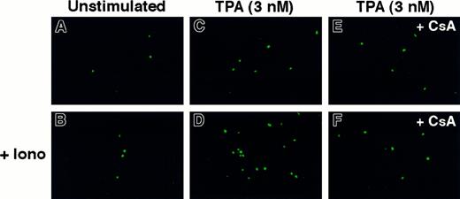 Fig. 6. Calcineurin mediates Ca++-dependent KSHV reactivation in DMVEC. / Immortalized DMVEC monolayers were infected with KSHV, as described previously.23 Three days after incubation with ionomycin, low-dose TPA, or both, monolayers were fixed, permeabilized, and blocked with 20% normal goat serum. Then monolayers were stained with anti–PF-8 mAb followed by FITC-conjugated goat antimouse secondary mAbs. Representative fields were photographed on a Nikon fluorescence microscope (magnification, 10×). Unstimulated cells (A), 1 μg/mL ionomycin (B), 3 nM TPA (C), TPA + ionomycin (D), TPA + 0.5 μM CsA (E), TPA + ionomycin + CsA (F).