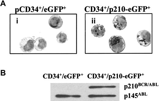 Fig. 2. p210BCR/ABL is expressed in p210-eGFP–transduced GFP+ CD34+ cells. / (A) p210-eGFP– or eGFP-transduced GFP+ CD34+cells were cytospun onto glass slides and fixed in 100% ethanol for 20 minutes. Endogenous peroxidase was blocked with 0.3% H2O2 in 50% methanol for 5 minutes. Immunohistochemistry was performed using an established avidin-biotin complex with specific primary anti-BCR antibody. Staining is significantly greater in the cytoplasm of p210-eGFP–transduced eGFP+ CD34+ cells (ii) than in eGFP-transduced eGFP+ CD34+ cells (i). Representative example of 2 individual experiments is shown. (B) Proteins were extracted from 5 × 105 p210-eGFP– or eGFP-transduced GFP+CD34+ cells. Proteins were resolved by electrophoresis on 8% polyacrylamide gels and transferred to polyvinylidene difluoride. Blots were incubated with anti-ABL antibody and a goat antimouse horseradish peroxidase–conjugated antibody, as described in “Materials and methods.” Protein bands were visualized using an ECL detection system. p210BCR/ABL was present in p210-eGFP– but not in eGFP-transduced eGFP+ CD34+ cells at levels similar to those of endogenous p145ABL. Representative example of 2 individual experiments is shown.
