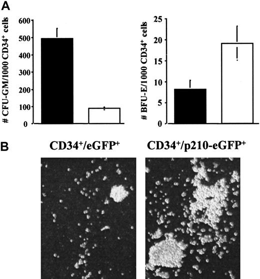 Fig. 8. Presence of p210BCR/ABL in normal CD34+ cells increases number of GM-CFU. / p210-eGFP– or eGFP-transduced GFP+ CD34+ cells (103) from 4 umbilical cord blood samples were plated in methylcellulose assay with SCF, GM-CSF, and IL-3 each at a final concentration of 5 ng/mL and erythropoietin at 3 IU/mL. After 14 days, GM-CFU and BFU-E were enumerated separately, and the size of colonies was assessed visually. (A) Significantly greater numbers of GM-CFU in 103 p210-eGFP– (▪) than eGFP-transduced (■) GFP+ CD34+ cells and similar numbers of BFU-E in either population. Comparison between GM-CFU in 103p210-eGFP– and eGFP-transduced GFP+ CD34+cells (P = .001). (B) In addition, the size of GM-CFU was significantly greater in p210-eGFP– than in eGFP-transduced GFP+ CD34+ cells.