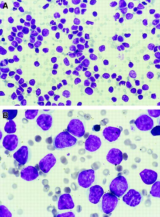 Fig. 2. Hematopoietic cell infiltration of organs and PB. / (A) PB of MFINV-TD secondary recipient (pre-B cell by FACS) (original magnification × 40). (B) Peripheral blood of MFINV-TD secondary recipient demonstrates an acute lymphoblastic leukemia confirmed to be of pre-B-cell phenotype by FACS (original magnification × 100).