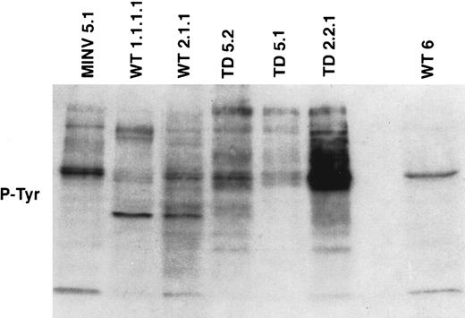 Fig. 8. Variation in global tyrosine phosphorylation patterns in FGFR3-TD and FGFR3-WT mice. / Global phosphotyrosine patterns were compared from mice that developed tumors (WT1.1.1.1, WT2.1.1, TD5.2, TD5.1, TD2.2.1) and from controls (MINV5.1, WT6). Distinct variation in banding patterns was observed.