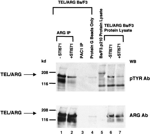 Fig. 3. Inhibition of TEL/ARG autophosphorylation by STI571. / TEL/ARG was immunoprecipitated from TEL/ARG-transfected Ba/F3 cells cultured in the absence or presence of STI571 for 24 hours (lanes 1 and 2, respectively). An anti-PAC1 polyclonal goat antibody was used to immunoprecipitate the phosphatase PAC1 as a nonspecific control (lane 3). Protein lysate from TEL/ARG-Ba/F3 cells was also incubated in the presence of protein G beads alone, as a nonspecific control (lane 4). Immunoblotting was performed on all samples with anti-pTYR (upper panel) and anti-ARG (lower panel). Whole cell lysates from TEL/ARG-Ba/F3 cells cultured in the absence and presence of STI571 (lanes 6 and 7, respectively) were run in parallel with the immunocomplexes, and immunoblotting was similarly performed on these samples with anti-pTyr (upper panel) and anti-ARG (lower panel). Whole cell lysate from Ba/F3.p210 cells was run alongside whole cell lysates from TEL/ARG-Ba/F3 cells for comparison (lane 5). IP indicates immunoprecipitation.