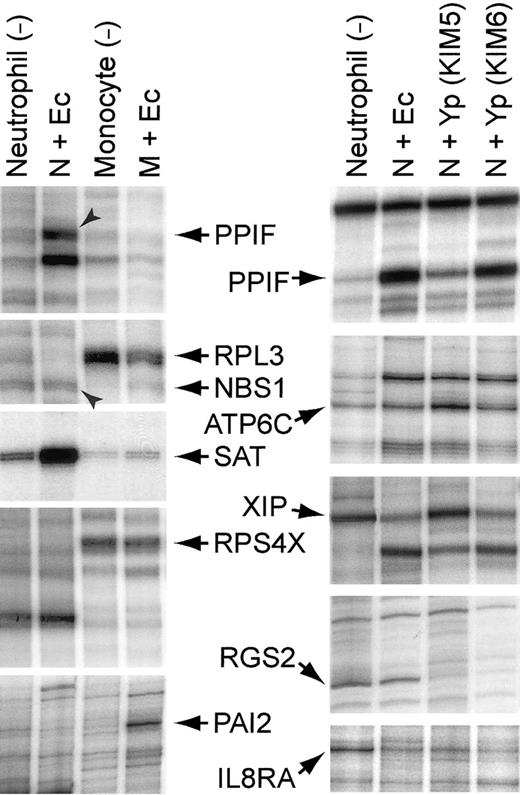 Fig. 2. Representative segments of display gels of cDNA fragments: left, neutrophils and monocytes exposed to. / E coli for 2 hours; right, neutrophils exposed to various bacteria for 2 hours. After incubating the leucocytes with or without bacteria at 37°C for 2 hours, total RNA was extracted, and double-stranded oligo-dT primed cDNA was synthesized by standard methods. The cDNA was digested with a restriction enzyme and ligated with a Y-shaped adapter. Ligated cDNA was amplified by PCR with a phosphorous 32 (32P)–labeled primer complementary to one arm of the Y-shaped adapter and a second primer complementary to the oligo-dT primer and containing one of the 12 possible dinucleotide extensions on its 3′-end, as previously described.12 Ec indicates E coli K12; Yp (KIM5), Y pestis KIM5 (pCD1+); Yp (KIM6), Y pestis KIM6 (pCD1−); N, neutrophil; and M, monocyte. Gene symbols are the same as those described in Tables 4-6, except for the following:PAI2, plasminogen activator inhibitor, type II (arginine-serpin) (GenBank Accession no. Y00630); RPL3, ribosomal protein L3 (X73460); and RPS4X, ribosomal protein S4, X-linked (M58458).