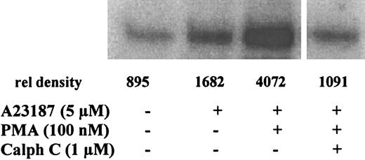 Fig. 6. PMA up-regulates 5-LO phosphorylation by MK2 in MM6 cells: inhibition by calphostin C. / Phosphorylation of 5-LO by immunoprecipitates of MK2 from MM6 cells was determined by in vitro kinase assays. Differentiated MM6 cells (2.5 × 107 in 1 mL PGC buffer) were incubated with the indicated concentrations of calphostin C for 30 minutes at 37°C under ordinary fluorescent light. Then PMA (100 nM) was added for 10 more minutes before stimulation with 5 μM A23187 for 3 minutes at 37°C. Incubations were stopped by the addition of 2 vol ice-cold stop-buffer. MK2 was immunoprecipitated, and aliquots of the MK2-IPs corresponding to the same cell numbers were subjected to in vitro kinase assay with 5-LO (3 μg) as substrate. Results are representative of at least 3 separate experiments.