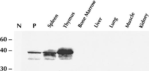Fig. 1. The TK transgene is expressed only in the spleen and thymus. / Western blot analysis of protein lysates derived from specified TK+ founder line tissues were probed with a rabbit polyclonal anti-TK antibody. N signifies the negative control (HU-143B human fibroblast cell line that is TK−). P denotes the positive control (AKR murine leukemia cell line transfected with the TK cDNA).