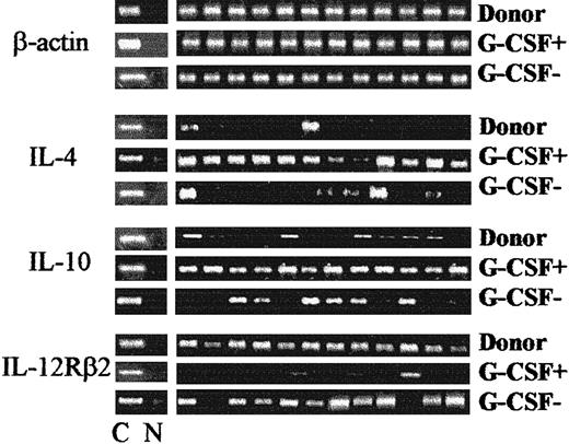 Fig. 2. Effect of postgrafting administration of G-CSF on Th-cell functional phenotype in HLA-mismatched recipients of hematopoietic transplants. / Shown are IL-4, IL-10, and IL-12Rβ2–chain gene expression by PHA-derived CD4+ clones from patients treated with G-CSF (G-CSF+) compared with patients not treated with G-CSF (G-CSF−). Shown are RT-PCR analyses from one donor, one patient treated with G-CSF, and one patient not treated with G-CSF (both 3 months postgrafting); these are representative of analyses done in 10 donors and in all patients between 2 and 6 months postgrafting. C indicates β-actin–specific, cytokine-specific, or cytokine receptor–specific control; and N, no DNA added to the amplification mix during PCR.
