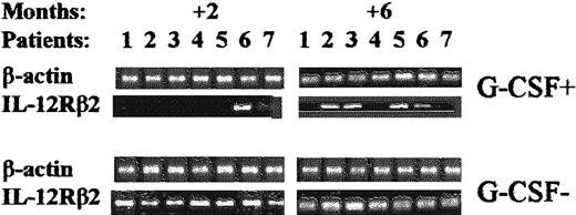 Fig. 3. Effect of postgrafting administration of G-CSF on the kinetics of recovery of IL-12Rβ2–chain gene expression in HLA-mismatched recipients of hematopoietic transplants. / Shown are the time kinetics of IL-12Rβ2 gene expression in PBMC samples from patients treated with G-CSF (G-CSF+) compared with patients not treated with G-CSF (G-CSF−). Representative RT-PCR analyses done 2 and 6 months postgrafting are depicted. In contrast to the findings in patients treated with G-CSF, IL-12Rβ2mRNA was detected 2 months after transplantation in all patients not given G-CSF.