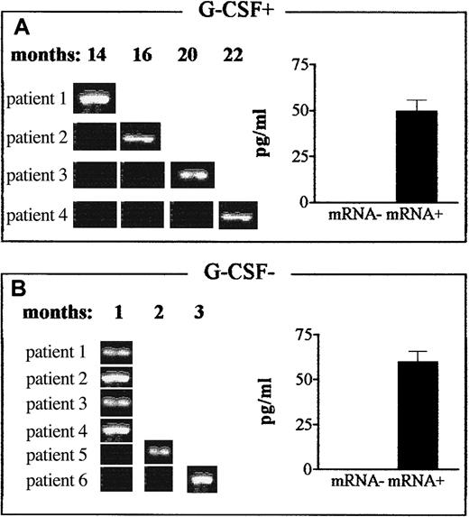Fig. 5. Effect of postgrafting administration of G-CSF on production of IL-12 by DCs in HLA-mismatched recipients of hematopoietic transplants. / Expression of the gene for the inducible IL-12p40 subunit and production of the bioactive IL-12p70 protein were determined in DCs from G-CSF–treated patients (G-CSF+, panel A) and patients not given G-CSF (G-CSF−, panel B). In patients who received G-CSF postgrafting, DCs expressing the IL-12p40 gene were first detected 14 to 22 months after transplantation, whereas they were first detected 1 to 3 months in patients not given G-CSF (RT-PCR results, left side of each panel). Patients were chosen randomly for this analysis at the time of transplantation, and data are representative of more extensive analyses in patients in both series. ELISA analyses (right side of each panel) confirmed that IL-12p40 gene expression (mRNA+) correlated with actual production of bioactive IL-12 in each treatment protocol, ie, in G-CSF–treated patients (G-CSF+, panel A) and patients not given G-CSF (G-CSF−, panel B). The ELISA results are mean ± SE values for IL-12 production by IL-12p40 mRNA+ samples in the 2 series.
