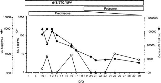 Fig. 2. Detection of vIL-6, hIL-6, and HIV RNA in serial serum samples from an HIV-positive patient with MCD. / On day 1, prednisone treatment was initiated. vIL-6 levels were measured by a vIL-6–specific enzyme-linked immunosorbent assay (ELISA) established in our laboratory.6 hIL-6 was measured by a commercially available ELISA kit (R&D Systems, Minneapolis, MN) that does not detect vIL-6.6 The lower limit of ELISAs sensitivity in serum was calculated to be 300 pg/mL of vIL-6 and 1.0 pg/mL of hIL-6. HIV-RNA load was measured by Amplicor HIV-1 reverse transcriptase–polymerase chain reaction test (Roche Diagnostic Systems, Basel, Switzerland), kindly performed by Dr Timothy Alcorn, Laboratory Corporation of America. 3TC indicates lamivudine; d4T, stavudine; and NFV, nelfinavir.