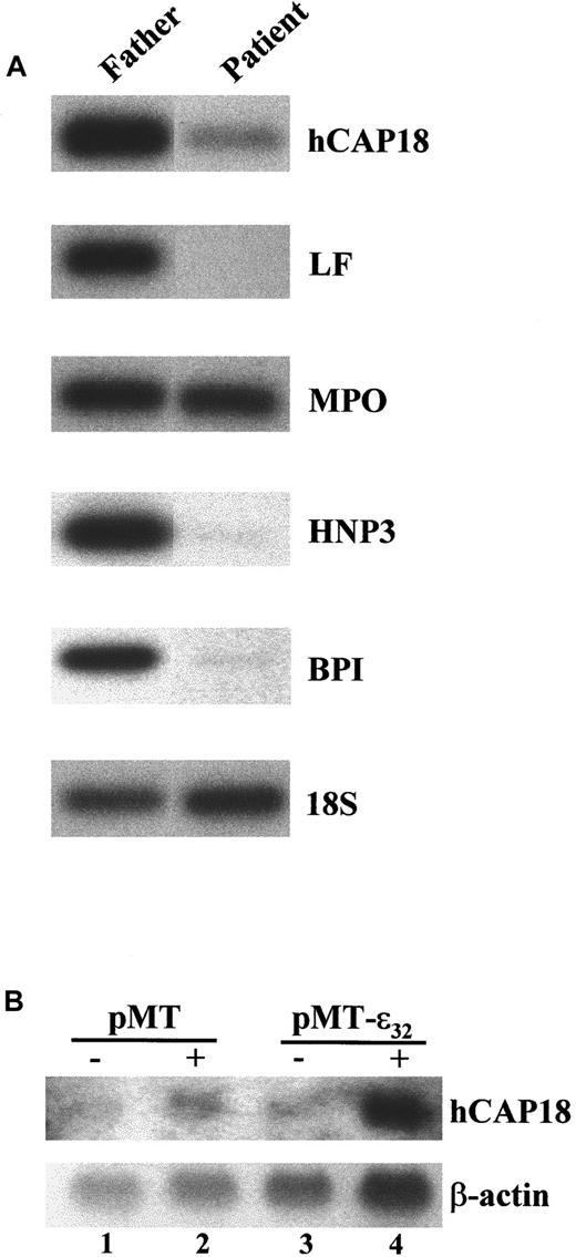 Fig. 4. Expression of mRNA encoding the secondary granule protein hCAP18 and primary granule protein BPI is severely reduced in the PBMCs of the SGD patient. / (A) RT-PCR analysis of total RNA prepared from the PBMCs of the patient and father. The cDNAs were analyzed for expression of the primary granule genes MPO, HNP-1 and HNP-3 (HNP1/3), and BPI; the secondary granule geneslactoferrin (LF) and hCAP18; and the control 18S rRNA. The products were Southern blotted and hybridized with either internal oligonucleotide or cDNA probes. (B) Induced expression of C/EBPε32 in U937 activates hCAP18 expression. U937 cells stably transformed with a zinc-inducible empty vector (pMT) or one containing an insert for C/EBPε32 (pMT-ε32) were treated either without (−) or with (+) 100 μM ZnSO4for 24 hours. RNA was harvested and analyzed by Northern blot hybridization with a probe for hCAP18. The blot was stripped and subsequently hybridized for β-actin.