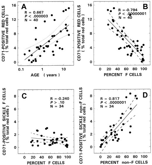 Fig. 3. CD71+ red cells and their relationship to age and F-cell and non–F-cell fractions. / Correlation between CD71+ red cells and age (A) and F-cell number (B) from 40 patients with SS disease are presented. Red cells from 34 patients with SS disease were analyzed for CD71+ F cells (C) and CD71+ non–F cells (D) and their respective relationships to F-cell and non–F-cell fractions. The solid line represents the linear-regression fit to the data, and the dotted lines represent the 99% confidence interval curves.