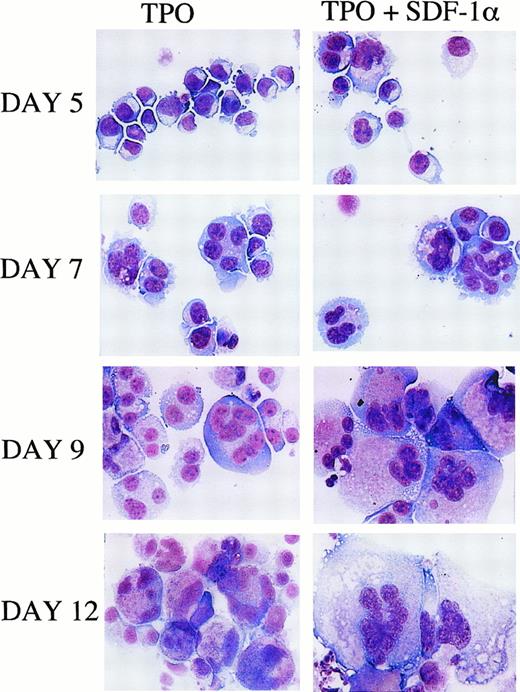 Fig. 1. Morphology of megakaryocytic cells grown in presence of TPO alone or combined with SDF-1α. / Cell morphology of HPCs, derived from PB, cultured in serum-free liquid suspension medium in the presence of TPO (100 ng/mL) or TPO + SDF-1α (1 μg/mL) (representative results). Cells at different days of culture are presented (May-Grünwald staining; original magnification × 400).