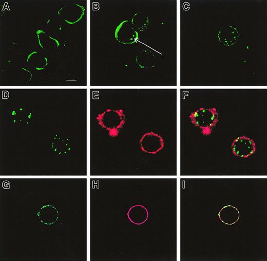 Fig. 8. Internalization of CXCR4 after exposure to SDF-1α. / Internalization of CXCR4 was analyzed by confocal laser scanning microscopy in HPCs. (A) Untreated cells. (B) Cells after exposure to 1 μg/mL of SDF-1α for 30 minutes. (C) Cells after exposure to 1 μg/mL of SDF-1α for 1 hour. (D-I) Double immunofluorescence for CXCR4 (green) and CD41 (red) on day 3 cells, cultured in the presence of SDF-1 (D-F), compared with control cells (G-I). The yellow area in panel I indicates the colocalization of both the receptors on the membrane (bar = 10 μm).