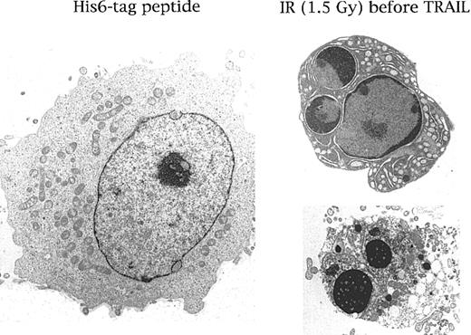 Fig. 5. Ultrastructural examination of HEL cells treated with His6-tag control peptide or with the combination of IR (6 hours before) plus TRAIL (1 μg/mL). / Note that in comparison with the normal morphology shown in the left panel, several HEL cells, on treatment with IR plus TRAIL, showed a characteristic chromatin cap (right upper panel) and the formation of micronuclei (right lower panel) typical of apoptosis. Representative results from 1 of 7 separate experiments are shown.