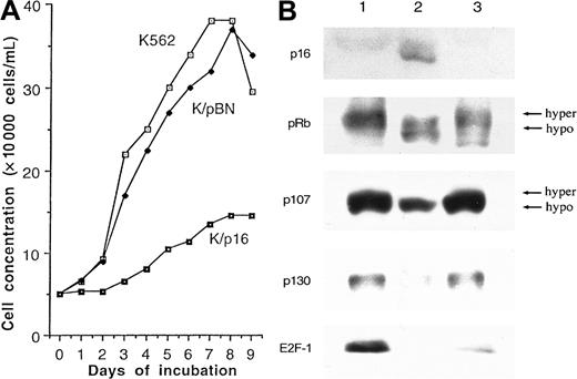 Fig. 1. K562 cells. / (A) Growth curves for p16INK4a-transduced (K/p16), empty vector–transduced (K/pBN), and untransduced K562 cells. The p16INK4a-transduced and empty vector–transduced cells, but not the parental cells, were cultured in the presence of G418. The results are from the 1 experiment (out of 4) in which the p16INK4a-transduced cells showed any significant growth. (B) Western blot analysis of untransduced K562 cells (lane 1), K562 cells transduced with p16 (lane 2), and cells transduced with empty vector (lane 3) after 16 passages. The results show expression of p16INK4a by the p16INK4a-transduced cells. Expression of p16INK4a (lane 2) results in loss of the hyperphosphorylated forms of pRB and p107 and in reductions in the expression levels of p107, p130, and E2F-1.
