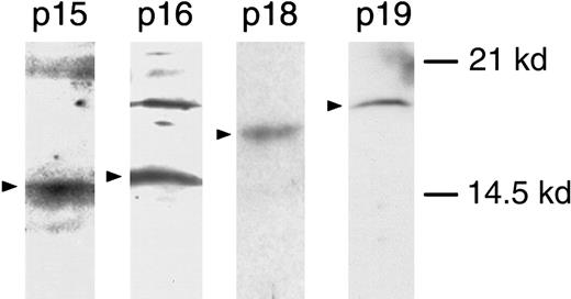 Fig. 3. Western blot analysis of cell lysates. / Western blot analysis of INK4 proteins in CD34+ cell lysates using antibodies against p15, p16, p18, and p19.