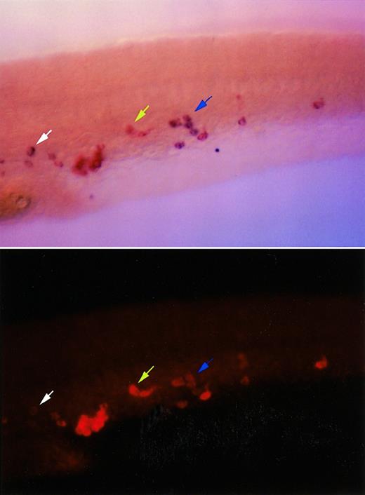 Fig. 4. Coexpression pattern of c/ebp1 andl-plastin in zebrafish embryos. / RNA in situ hybridization was performed using a digoxigenin-labeled c/ebp1 RNA antisense probe developed with BM purple, and a fluorescein-labeled l-plastin RNA antisense probe developed with fast red. Lateral views of a tail region immediately caudal to the yolk sac extension oriented with the head to the left are shown. In the upper panel a bright field view of an in situ hybridized 24-hpf embryo shows l-plastin staining in red and c/ebp1 staining in purple. The lower panel shows the same view with l-plastin staining visualized with a rhodamine filter under fluorescence, photographed with a Quantix CCD camera, and pictured with red pseudocoloring using IP lab software. The blue arrow shows cells expressing both c/ebp1 andl-plastin. The yellow arrow indicates a cell with undetectable expression of c/ebp1, but strong expression ofl-plastin. The white arrow shows a cell with high expression of c/ebp1, but minimal l-plastinexpression.