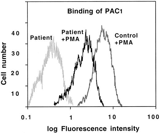 Fig. 5. PAC1 binding to activated platelets. / Platelets from the thrombasthenic patient and normal controls were incubated with or without PMA (20 nmol/L) for 5 minutes and then incubated with the moAb FITC-PAC1 and analyzed by flow cytometry.