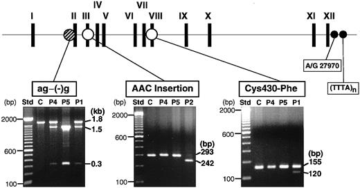 Fig. 2. Screening of known mutations by PCR-RFLPs. / The locations of 3 known mutations in the XIIIB gene are indicated at the top. PCR-RFLP analyses were performed for 2 new patients (patient 4, P4; patient 5, P5), a normal control (C), and 2 previously identified patients (P1, P2): for the ag−(−)g mutation, a 1.8-kb amplified fragment was treated with TaqI; for the AAC insertion, a 430-bp amplified fragment withTru9I; for the Cys430-Phe mutation, a 155-bp amplified product with MboII. Each reaction mixture was electrophoresed in 1%, 2%, and 2% agarose gels, respectively. Patient 1 (P1) was a positive control for the ag−(−)g and Cys430-Phe mutations and patient 2 (P2) for the AAC insertion. Std indicates standard size markers (100-bp ladder). Two polymorphic sites (A/G27970 and TTTA repeats) at the 3′-flanking region of the XIIIBgene were also indicated by small filled circles.