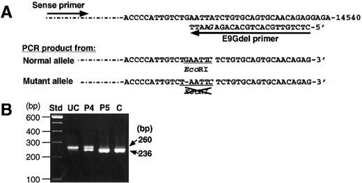 Fig. 4. Detection of the delG mutation by PCR-RFLP. / (A) A mutagenic primer (E9Gdel) with one base mismatch (G in italics) was designed to create an EcoRI site only in the PCR product with a normal sequence. (B) Amplified products from patients (patient 4, P4; patient 5, P5), and a normal control (C) were treated withEcoRI and then electrophoresed in a 2% agarose gel. The product of 260 bp amplified from the normal allele is cleaved into 2 fragments of 236 bp and undetectable 24 bp. An uncleaved PCR product (UC) amplified from patient 4 was also applied as a negative control.