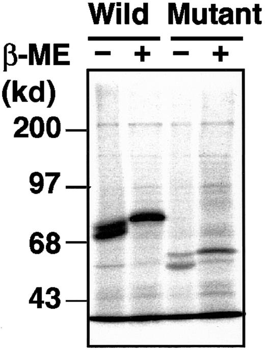 Fig. 5. Metabolic labeling of the wild-type and mutant rXIIIBs. / Radiolabeled cell lysate and culture medium, harvested at 0 hour after labeling, were immunoprecipitated with an anti-XIIIB antibody, followed by 10% SDS-PAGE under nonreducing or reducing conditions, with or without β-mercaptoethanol (β-ME).