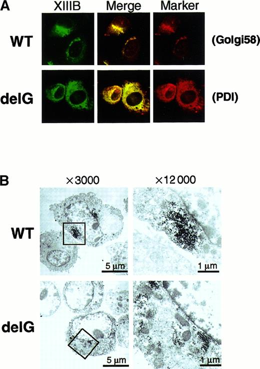 Fig. 7. Intracellular localization of wild-type and mutant rXIIIBs. / Immunocytochemical staining with an anti-XIIIB antibody and an anti-Golgi 58K protein (Golgi58) or anti-PDI antibody was carried out using BHK cells expressing wild-type (WT) or mutant rXIIIB (delG). The samples were examined by an epifluorescence microscope × 400 (A). Electron microscopic immunolocalization of rXIIIB was also performed using an anti-XIIIB antibody and ultrathin sections of infected BHK cells (B). Boxed areas of pictures on the left (× 3000) were reexamined at a magnification of × 12 000 (right).