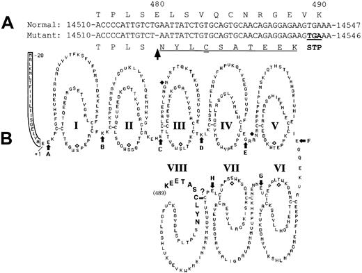 Fig. 8. Scheme of the mutant XIIIB. / The delG mutation (arrow) introduces a premature stop codon (double underlined) in the XIIIB gene with a frameshift (underlined) (A), resulting in the production of a truncated XIIIB (B) attached by 10 new amino acids (bold).
