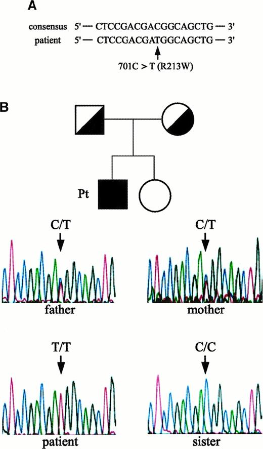Fig. 2. Missense mutation in the IL-12Rβ1 chain–encoding gene identified in the patient and his pedigree. / (A) A missense mutation identified in the patient: an amino acid substitution from arginine (CGG) to tryptophan (TGG) at position 213 (designated R213W). (B) Study of family members of the patient. Family pedigree and electropherograms for nucleotide 701 position (amino acid 213 position) in the IL-12Rβ1 chain–encoding gene of the index patient, his parents, and sister are shown. Note that the patient was homozygous for 701T (T/T), whereas both his parents were heterozygous (C/T) and his sister did not carry R213W (C/C).