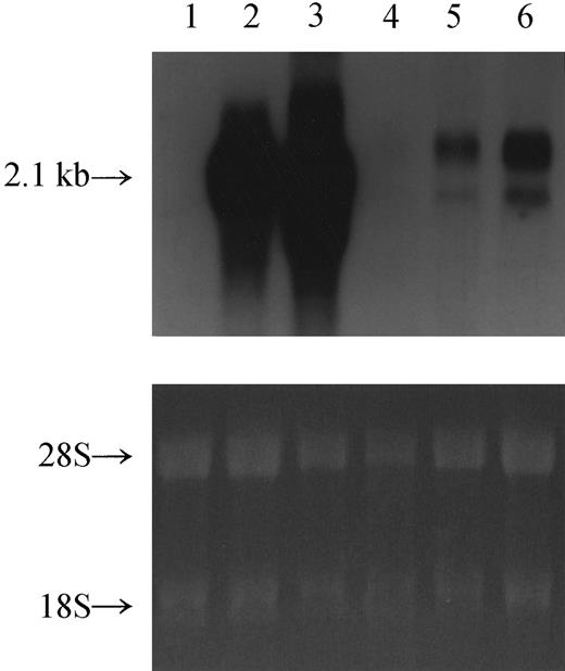 Fig. 4. Presence of transcripts of the IL-12Rβ1 gene in the patient's cells. / The presence of transcripts of the IL-12Rβ1 chain gene was examined with Northern blot analysis using a whole IL-12Rβ1 cDNA probe. Lane 1, HEKC293 cells transfected with a vector only; lane 2, HEKC293 cells transfected with the wild-type IL-12Rβ1 chain gene; lane 3, HEKC293 cells transfected with the mutated IL-12Rβ1 chain gene; lane 4, PHA-PBMCs from the patient; lane 5, PHA-PBMCs from a healthy subject; lane 6, patient's HTLV-1–immortalized TS1HTLV-1 cells. Lower panel shows 18S and 28S RNA species visualized by ethidium bromide staining, confirming that an approximately equal amount of RNA was applied to each lane. Note that the patient's PHA-PBMCs had IL-12Rβ1 transcripts at a distinct but lower level, but TS-1HTLV-1 cells had a substantial level of transcripts.