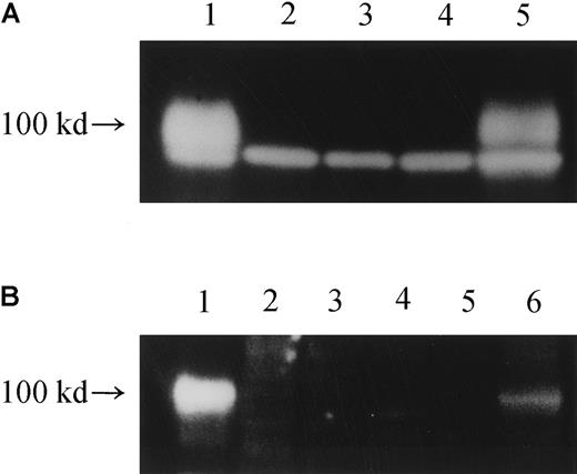 Fig. 5. Western blot analysis of the production of IL-12Rβ1 chains. / (A) Cell lysates from various cells were subjected to Western blot analysis using an antibody against the carboxy terminus of human IL-12Rβ1 protein (polyclonal), and the production of an IL-12Rβ1 chain protein of approximately 100 kd was examined. Lane 1, HEKC293 transfected with wild-type IL-12Rβ1wt gene; lane 2: HEKC293 transfected with mutated IL-12Rβ1R213W gene; lane 3, HEKC293 mock transfected with an expression vector only; lane 4, TS-1HTLV-1 cells; lane 5, cells from a healthy subject. The lower band represents a nonspecific band. (B) Cell lysates were similarly treated, but a different anti–IL-12Rβ1 antibody (polyclonal) was used to confirm the authenticity of the 100-kd band visualized. Lane 1, HEKC293 cells transfected with an expression vector carrying the wild-typeIL-12Rβ1wt gene; lane 2, HEKC293 cells transfected with expression vector carrying a mutated IL-12Rβ1 gene; lane 3, HEKC293 cells transfected with expression vector only (mock); lane 4, TS-1HTLV-1 cells, an HTLV-I–immortalized T-cell line derived from the index patient; lane 5, PHA-PBMCs from the patient; lane 6, PHA-PBMCs from a healthy subject. Note that the same 100-kd protein profile was seen in panels A and B.