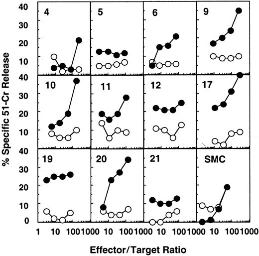 Fig. 1. Detection of HIV-specific CTL effectors ex vivo from individual white pulps from the spleen of patient B. / Target cells were autologous B-lymphoblastoid cells infected with either a mixture of recombinant vaccinia viruses expressing gag, pol, or env (●) or wild-type vaccinia (○). Results from 11 representative white pulps of the 24 tested and from bulk SMCs are shown.