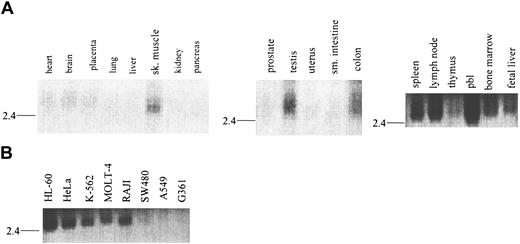 Fig. 3. Tissue distribution of RELT mRNA. / Northern blot analysis of RELT mRNA distribution in (A) normal human tissues and (B) transformed human cell lines.