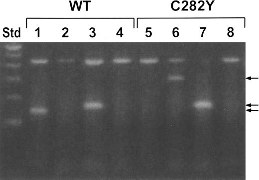 Fig. 1. Identification of the HFE gene by PCR. / WT and C282Y cells were analyzed for HFE and HFEgene mutations by allele-specific PCR. Primers specific for wild-typeHFE (C282 and H63) and mutant HFE (Y282 and D63) were used in PCR reactions on DNA isolated from the 2 cell lines. Lanes 1 and 5, C282 primers; lanes 2 and 6, Y282 primers; lanes 3 and 7, H63 primers; lanes 4 and 8, D63 primers. The 430-bp band (larger mol. wt. band) in all lanes represents a control PCR product. The other bands (arrows) are specific for HFE. Std (far left lane) is a 100-bp ladder standard.
