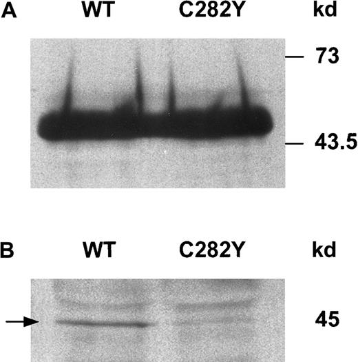 Fig. 2. HFE protein is expressed in WT and C282Y cells. / (A) Cell lysates from WT and C282Y cells were immunoprecipitated with anti-HFE antiserum and identified by Western blotting. HFE bands on membranes were identified by immunoblotting with anti-HFE antiserum, as described in the text. (B) HFE expression at the cell surface differs between WT and C282Y cells. Cell-surface proteins were labeled with biotin and immunoprecipitated with anti-HFE antiserum. Immunoprecipitates were resolved by SDS-PAGE and transferred to nitrocellulose membranes. Biotinylated HFE was identified with Streptavidin-HRP.