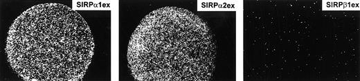 Fig. 1. Cell adhesion to SIRPα1ex and SIRPα2ex, but not to SIRPβ1ex. / SIRP fusion proteins (2 μL of 20 μg/mL solutions) were immobilized on nitrocellulose-coated Petri dishes by air-drying. Adhesion of Jurkat cells to SIRPα1ex, SIRPα2ex, and SIRPβ1ex was analyzed by incubating the cells for 1 hour at 37°C, as described.17Specific cell binding is shown in the round protein drop and was evaluated and photographed using a Zeiss Axiovert microscope (original magnification × 40; n = 3). SIRPα adhered to all tested CD47+ cell lines (HL-60, KG1a, K562, MO7e, 207, Daudi, CCRF-CEM, Molt-4, EM2, U937, and LAMA-84); adhesion of SIRPβ was always negative.