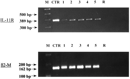 Fig. 3. IL-11R is expressed on the cell membrane of monocytes, T cells, and B cells. / IL-11R mRNA expression was found in highly purified CD19+(1), CD4+ (2), CD4+CD45RA+ (3), CD8+ (4), and CD14+ (5) cells by RT-PCR. IL-11R mRNA was detected at the expected site (389 bp). As a positive control (CTR), we used RNA obtained from the M07 megakaryoblastic cell line, which is known to express IL-11R. To exclude amplified cDNA contamination, a sample without RNA template served as negative control (R).