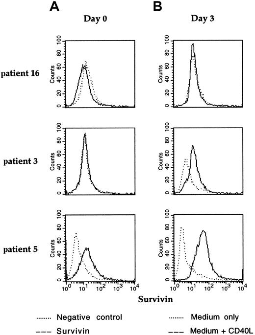 Fig. 1. Cytofluorometric analysis of Survivin expression. / Staining with mAb anti-Survivin at day 0 (A) and after 3 days of culture (B) of cells from 3 B-CLL patients, representative of the following groups: CD40L nonresponders (patient 16, Table 1); CD40L responders (patient 3, Table 1); patients whose cells were already Survivin+ at day 0 (patient 5, Table 1).