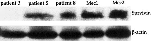 Fig. 2. Western blot analysis of cells and cell lines of B-CLL patients. / B-CLL cells were lysed and analyzed by SDS-PAGE and Western blotting using anti-Survivin mAb (top). Anti–β actin polyclonal antiserum (bottom) was used as control. Samples at diagnosis from 1 Survivin− (patient 3) and 2 Survivin+(patients 5 and 8) B-CLL patients are shown. Mec1 and Mec2 cell lines, grown in log phase, were used as controls. 3 × 106 cell equivalents per test were used.