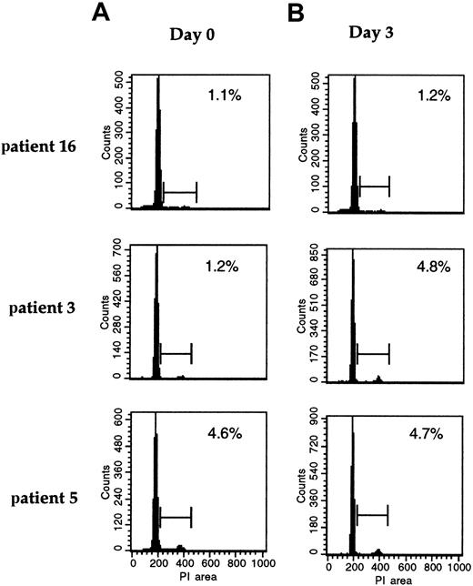 Fig. 3. Survivin expression correlates with the proliferative status of the cells. / Cell-cycle analysis of patient cells at day 0 (A) and after 3 days of culture with CD40L (B) in a CD40L nonresponder (patient 16, Figure 1), in a CD40L responder (patient 3, Figure 1), and in a patient already Survivin+ at day 0 (patient 5, Figure 1). PI, propidium iodide.