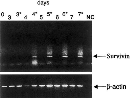 Fig. 5. Survivin expression is induced by CD40 stimulation. / RT-PCR analysis of Survivin expression in cells from a representative CD40L responder patient cultured in the presence (3*-7*) or the absence (0-7) of CD40L at the indicated time points (days). NC, negative control.