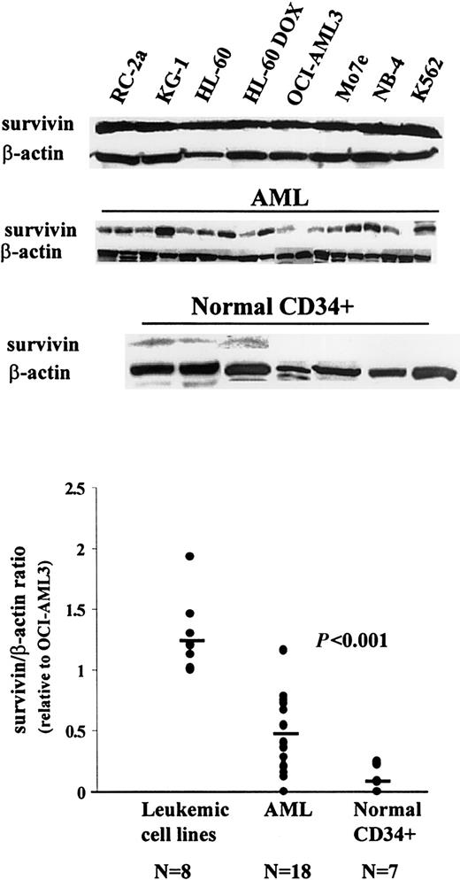 Fig. 1. Western blot analysis of survivin expression in leukemic cell lines, primary AML samples, and normal CD34+ cells. / Cell lysates equivalent to 0.5 × 106 cells were loaded on each lane. The experimental conditions are described in “Materials and methods.”