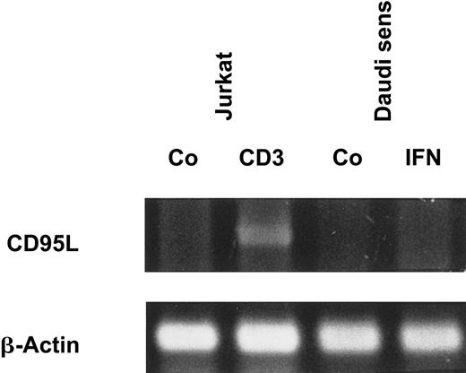 Fig. 2. IFN-α does not induce CD95L mRNA expression. / Daudi cells were stimulated as indicated for 20 hours. Jurkat cells, which were cultured with medium or coated CD3 monoclonal antibody for 4 hours, were used as positive control (Co). mRNA levels of CD95L and β-actin were assessed by RT-PCR, and PCR products were visualized after electrophoresis on a 1% agarose gel.